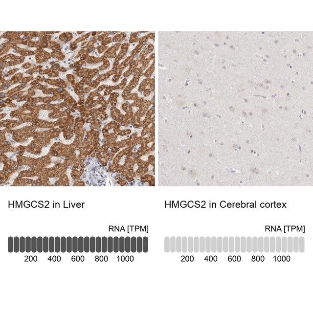 Anti-HMGCS2 antibody produced in rabbit