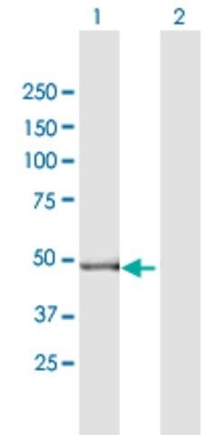 Anti-GPT2 antibody produced in mouse