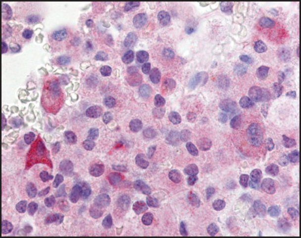 Anti-GPR37L1 (AB2) antibody produced in rabbit