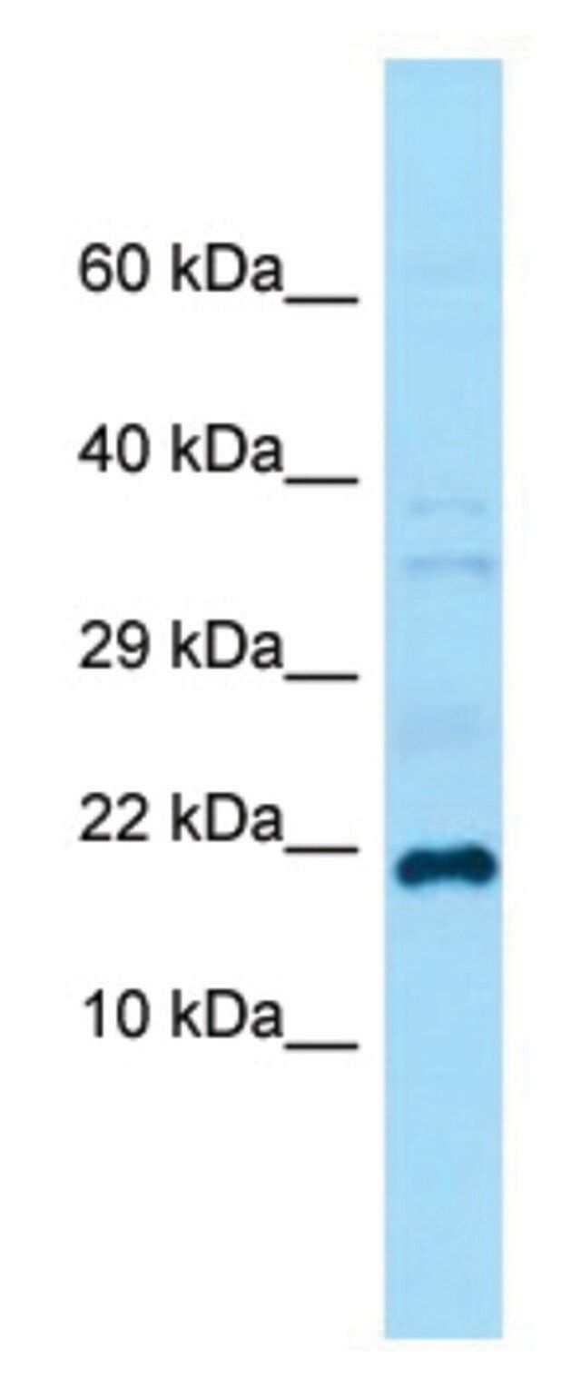 Anti-Grem1 (C-terminal) antibody produced in rabbit
