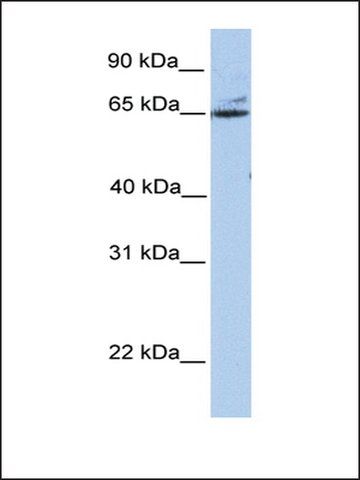 Anti-GPT2 antibody produced in rabbit