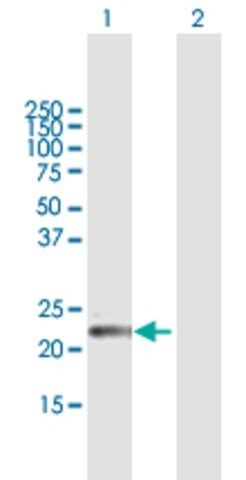 Anti-GPSM1 antibody produced in mouse
