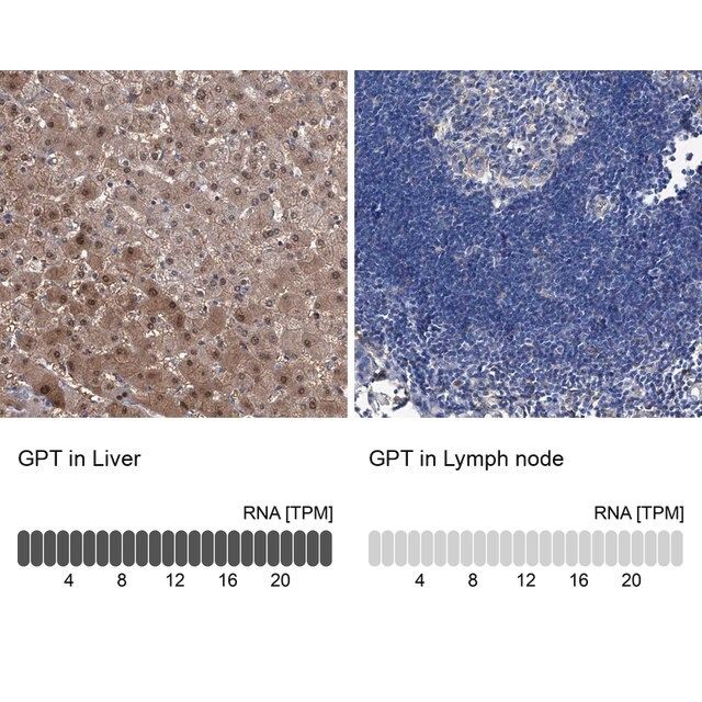 Anti-GPT antibody produced in rabbit