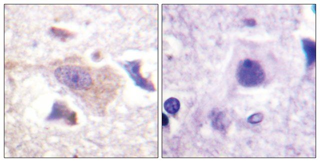 Anti-GRB10 antibody produced in rabbit