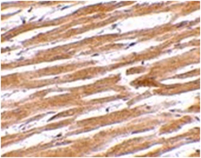 Anti-GPVI Antibody