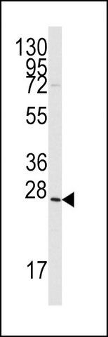 ANTI-GREMLIN (C-TERM) antibody produced in rabbit
