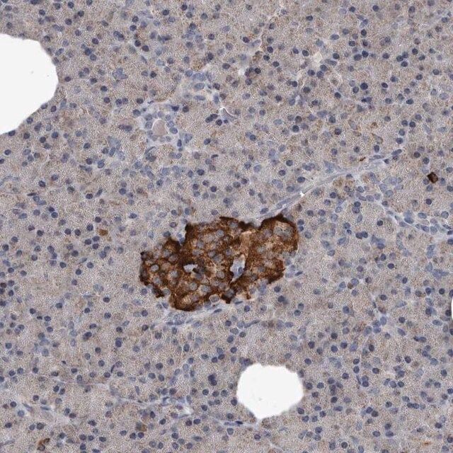 Anti-GREB1 antibody produced in rabbit