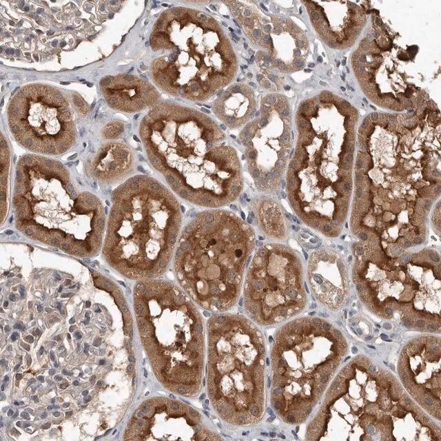 Anti-GRB10 antibody produced in rabbit
