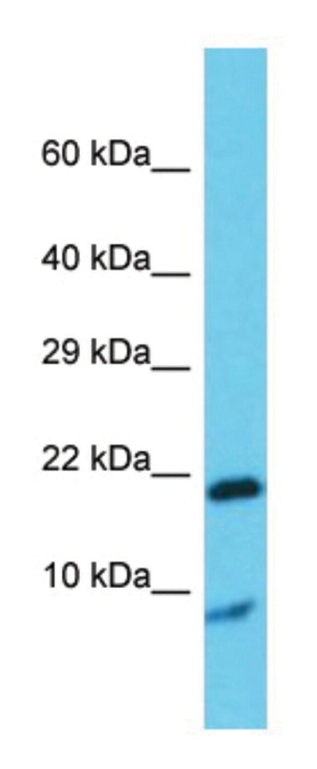 Anti-Grem1 antibody produced in rabbit
