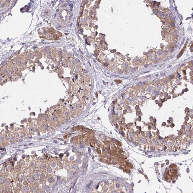 Anti-GRB14 antibody produced in rabbit