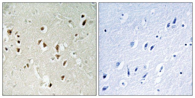 Anti-GRF-1 antibody produced in rabbit