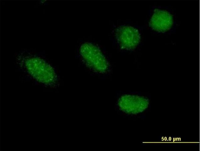 Anti-GRHL2 antibody produced in mouse