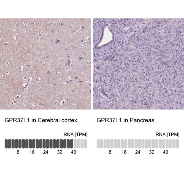 Anti-GPR37L1 antibody produced in rabbit