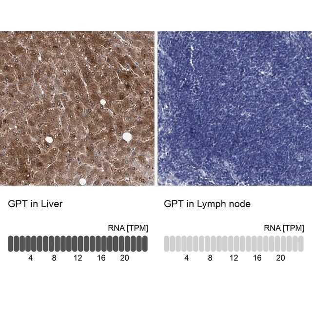 Anti-GPT antibody produced in rabbit