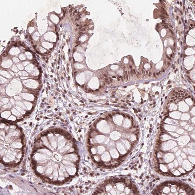 Anti-GPS2 antibody produced in rabbit