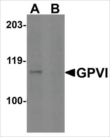 Anti-GPVI (ab2) antibody produced in rabbit