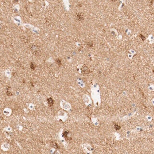Anti-GIT1 antibody produced in rabbit