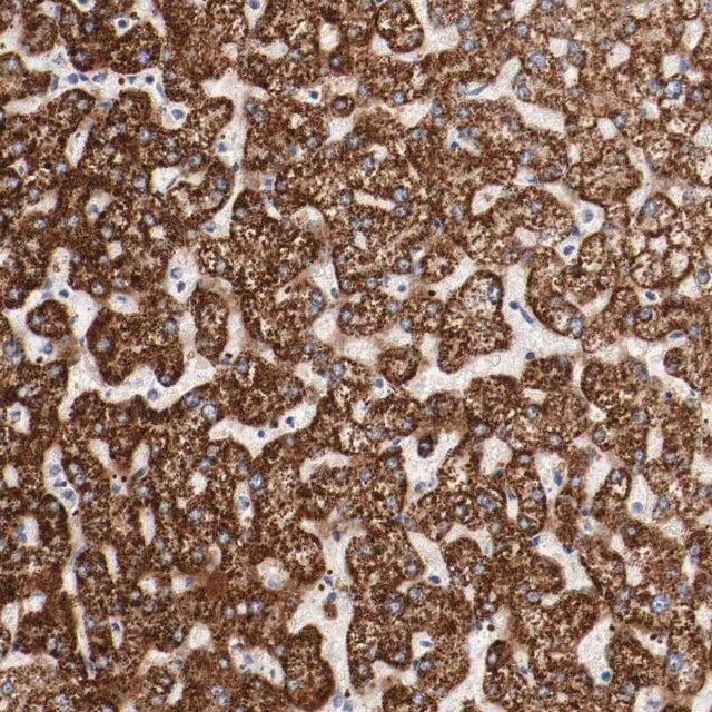 Anti-GIT1 antibody produced in rabbit