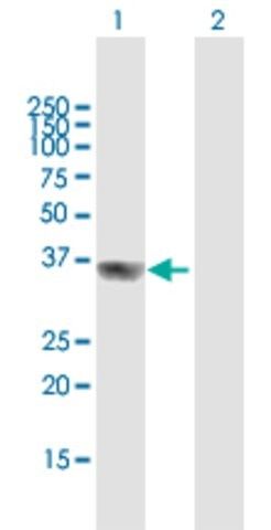 Anti-GIPC2 antibody produced in mouse