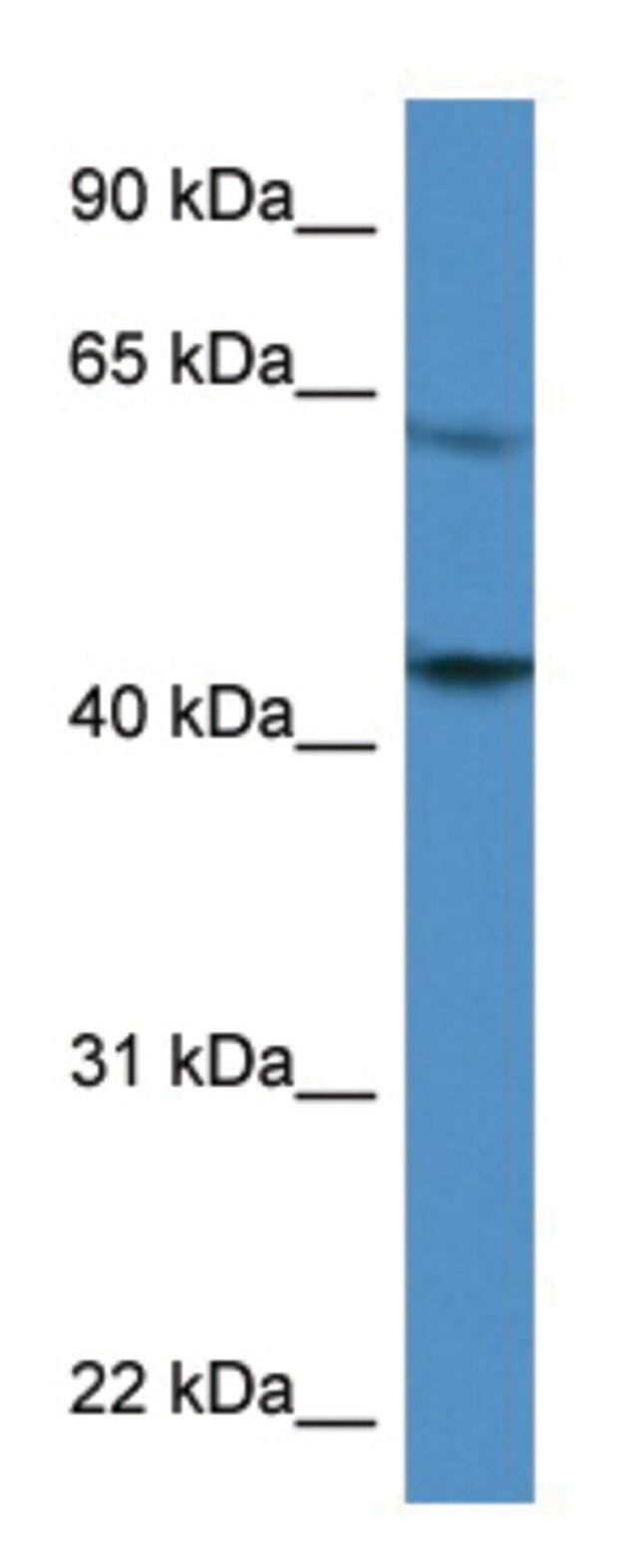Anti-F2R (C-terminal) antibody produced in rabbit
