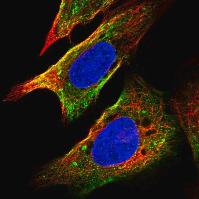 Anti-FRAT1 antibody produced in rabbit