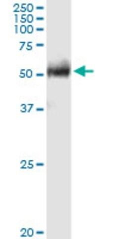 Anti-FPGT antibody produced in rabbit