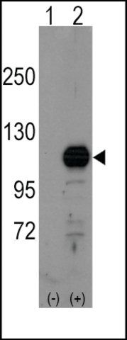 Anti-FRAT1 (center) antibody produced in rabbit