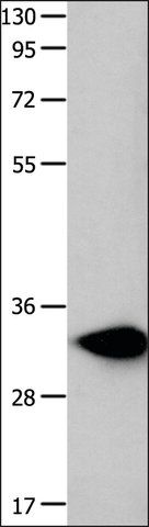 Anti-FOXS1 antibody produced in rabbit