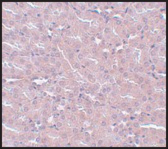 Anti-FRMPD2 antibody produced in rabbit