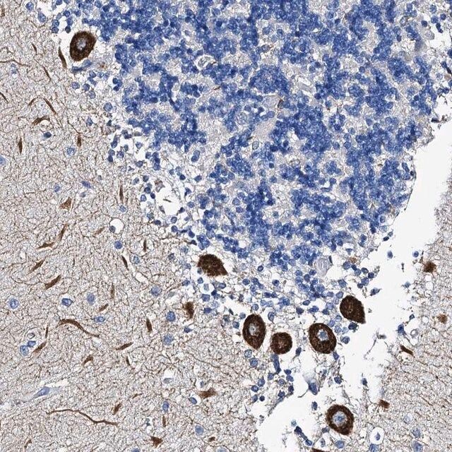Anti-FREM3 antibody produced in rabbit