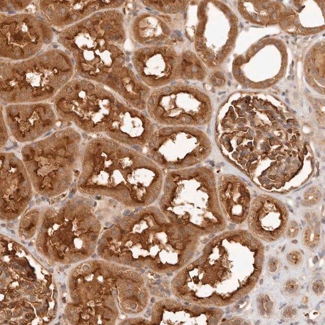 Anti-FREM2 antibody produced in rabbit