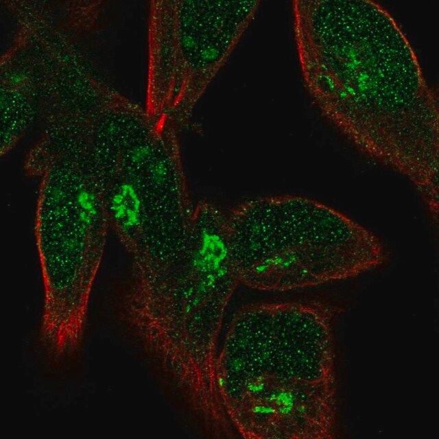 Anti-FPR1 antibody produced in rabbit