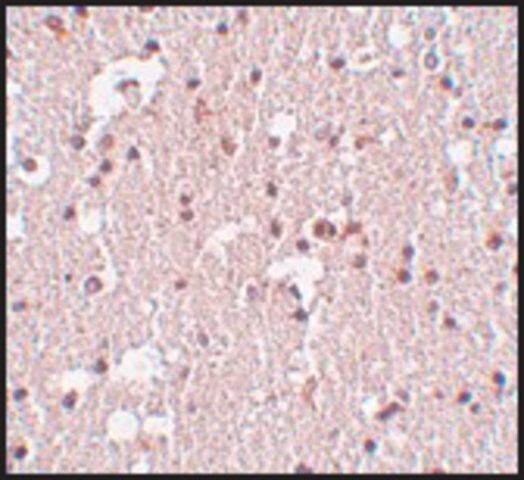 Anti-FRMPD3 antibody produced in rabbit