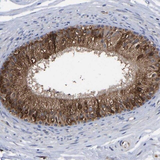 Anti-FRRS1 antibody produced in rabbit