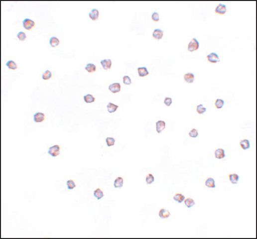 Anti-FREM2 antibody produced in rabbit