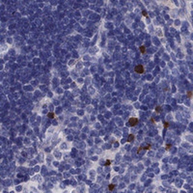 Anti-FRMD1 antibody produced in rabbit