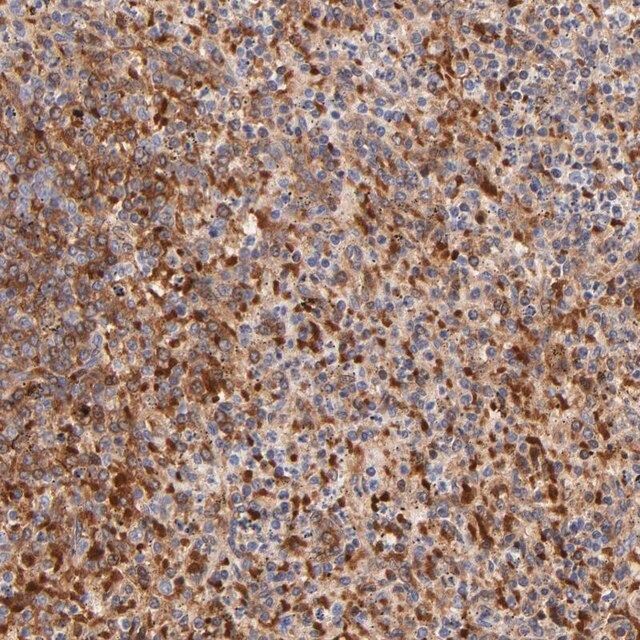 Anti-FRMPD3 antibody produced in rabbit
