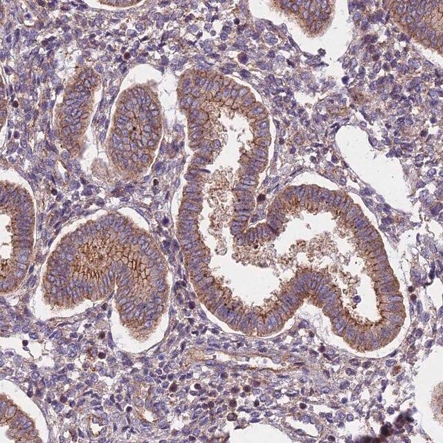 Anti-FRMPD1 antibody produced in rabbit