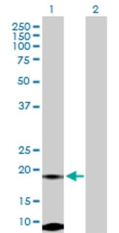 Anti-FUNDC2 antibody produced in rabbit