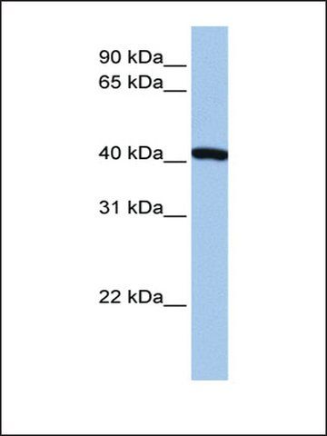 Anti-FTSJ1 antibody produced in rabbit