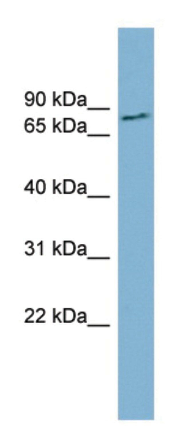 Anti-FURIN (N-terminal) antibody produced in rabbit