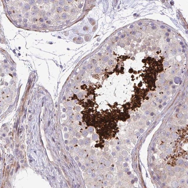 Anti-FUNDC2 antibody produced in rabbit