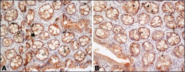 Anti-FUS antibody produced in rabbit