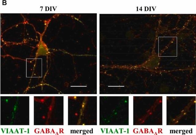 Anti-GABA A Receptor β 2,3 Chain Antibody, clone BD17