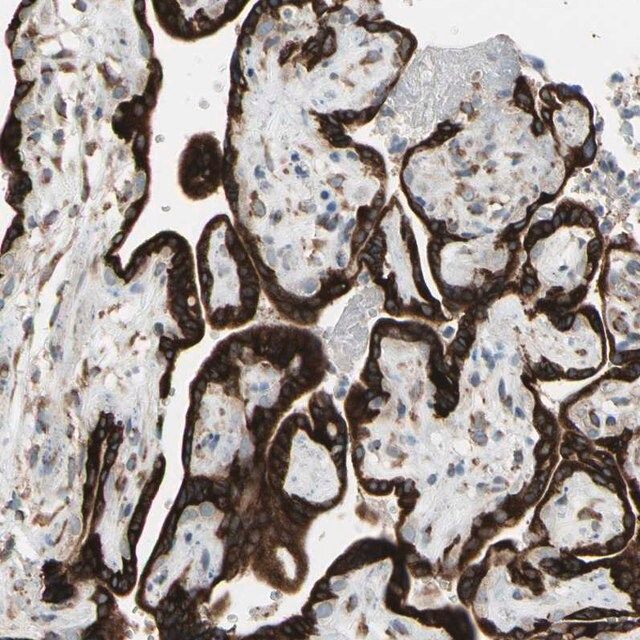 Anti-FNDC3A antibody produced in rabbit