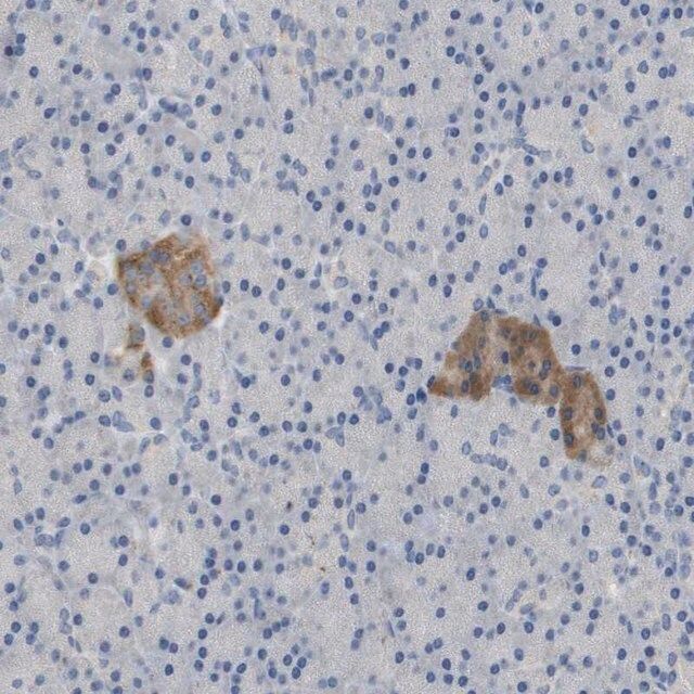 Anti-FNDC9 antibody produced in rabbit