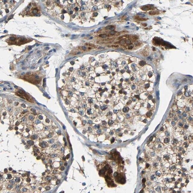 Anti-FNDC3A antibody produced in rabbit