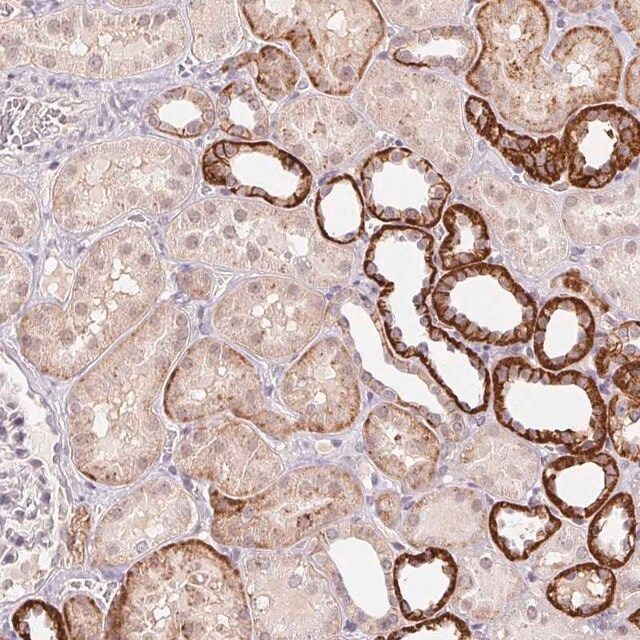 Anti-FNDC4 antibody produced in rabbit
