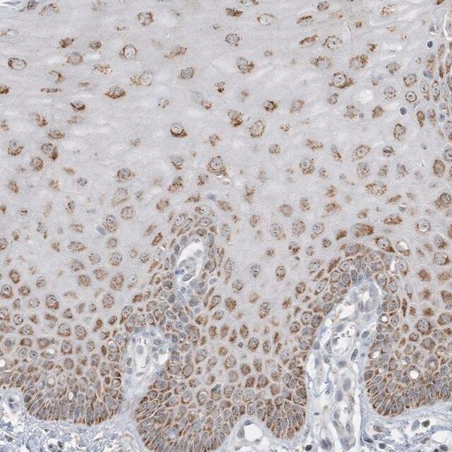 Anti-FNDC1 antibody produced in rabbit