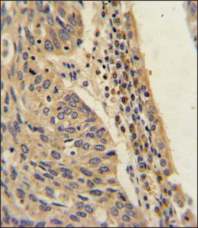 ANTI-FPGS (CENTER) antibody produced in rabbit